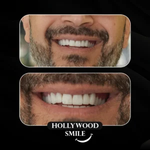 Crystal Istanbul Dental