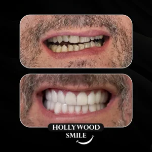 The Latest Dental Aesthetic Trends in Istanbul for 2024